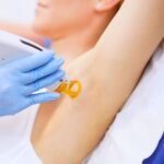laser-hair-removal-westlake-village-dr-bhuiya-remove-unwanted-hair-underarm